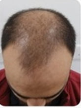 Customer — before