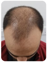Anonymous — before