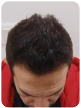 Customer — after