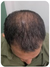 Customer — before