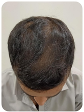 Customer — after