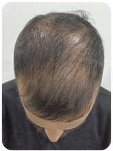 Customer — before